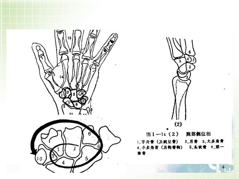 （推荐精选）腕关节X线解剖及常见骨折诊断.ppt_第4页