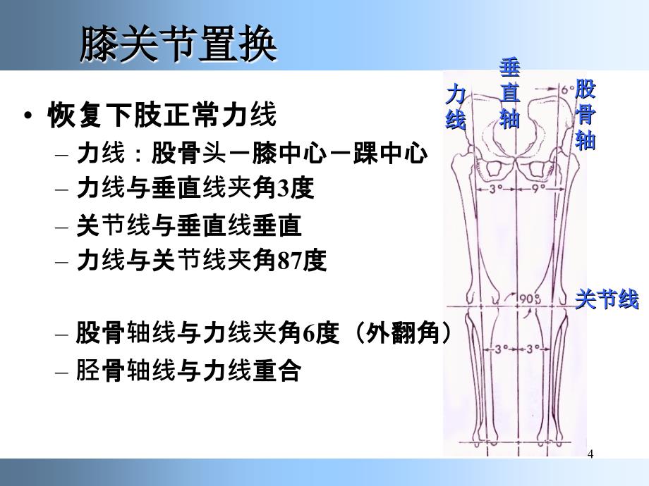 （推荐精选）膝关节置换标准技术.ppt_第4页