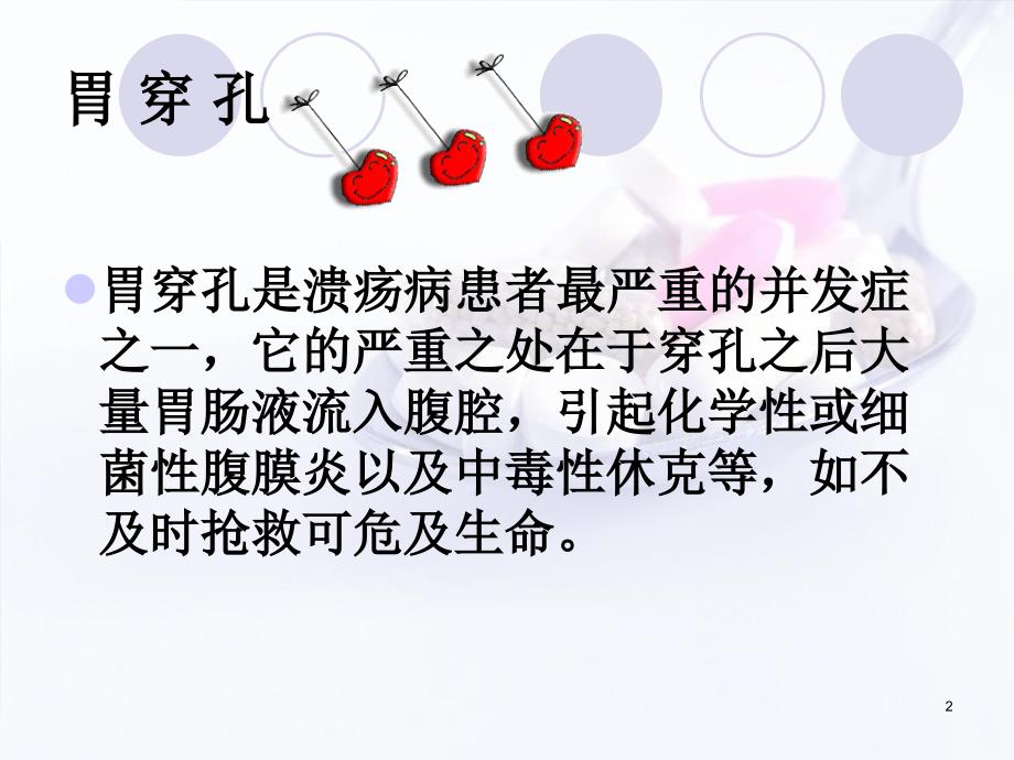 （推荐精选）胃穿孔的护理.ppt_第2页