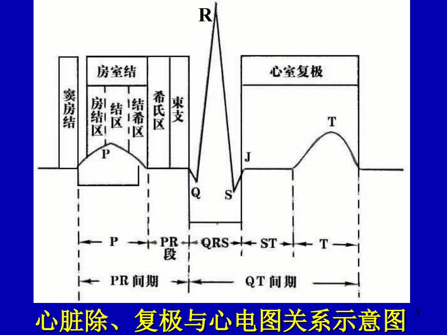 异常心电图的识别和处理PPT幻灯片.ppt_第3页