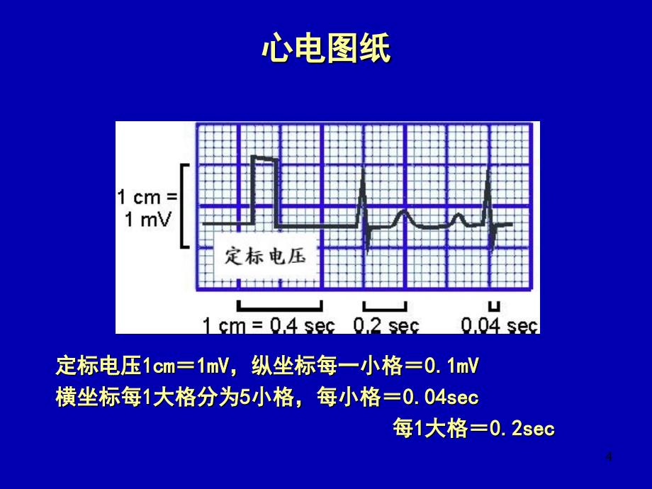 异常心电图的识别和处理PPT幻灯片.ppt_第4页