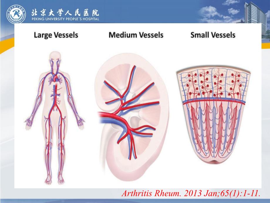 血管炎诊治新策略培训课件_第4页