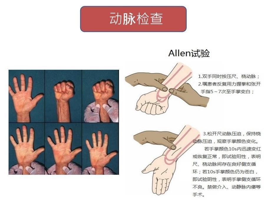 周围血管科体格检查ppt课件_第5页