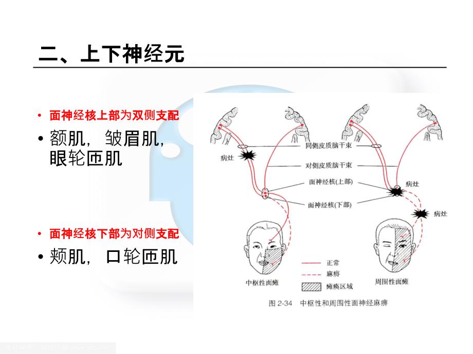 中枢性面瘫和周围性面瘫的区别ppt课件_第4页