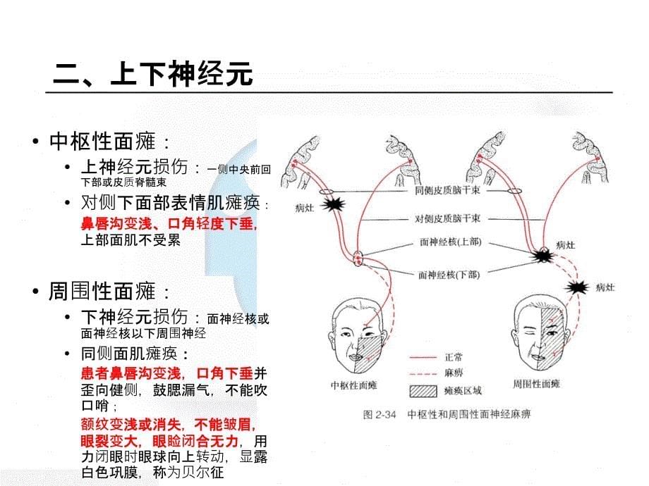 中枢性面瘫和周围性面瘫的区别ppt课件_第5页