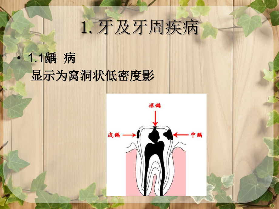 影像学牙牙周颌骨肿瘤样疾病ppt课件_第3页