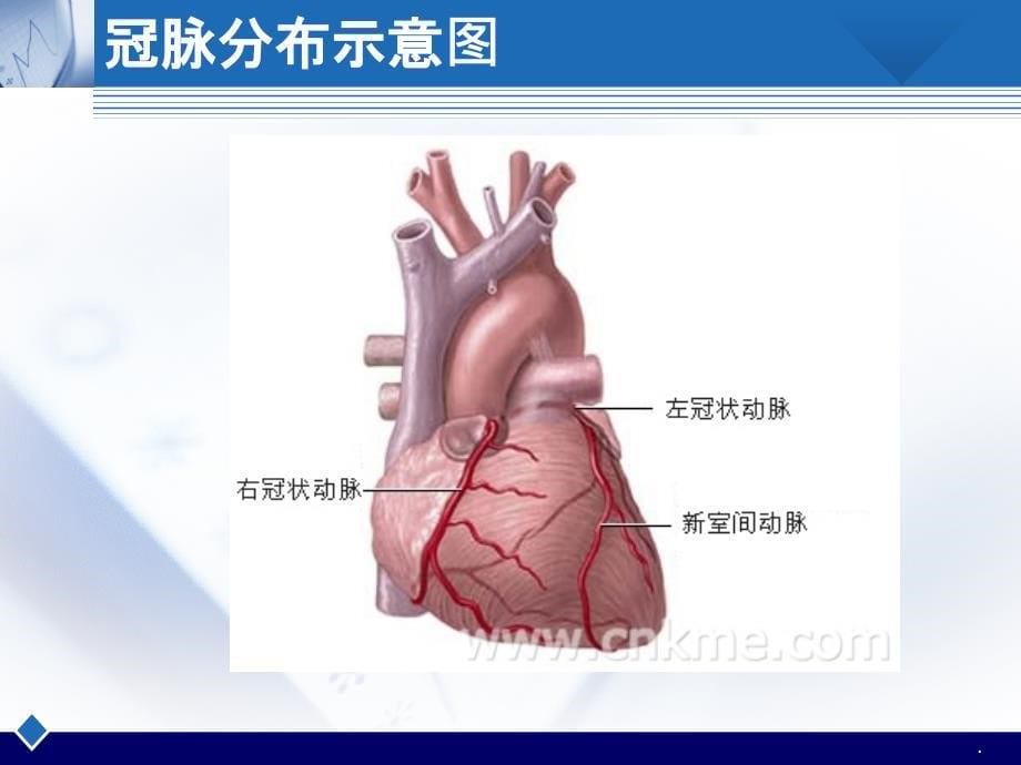 IABP护理查房_第5页