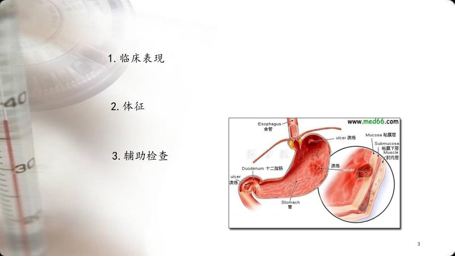 (医学)消化性溃疡的诊断与鉴别诊断_第3页