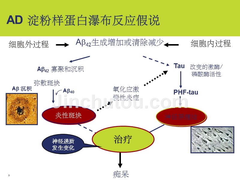 AD治疗新进展_第3页