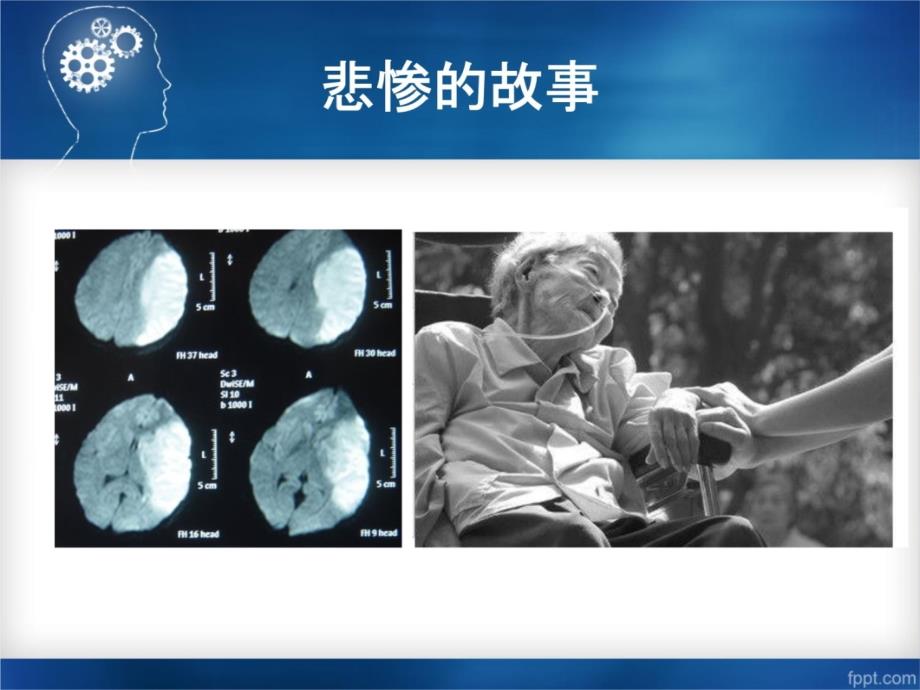 脑梗死的急救进展0309教学文案_第3页