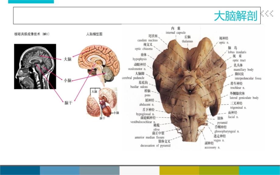 脑外伤患者护理查房教学提纲_第3页