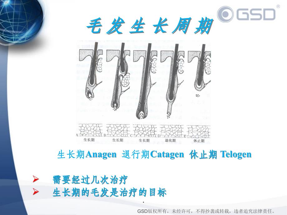 半导体激光脱毛系统ppt课件_第4页