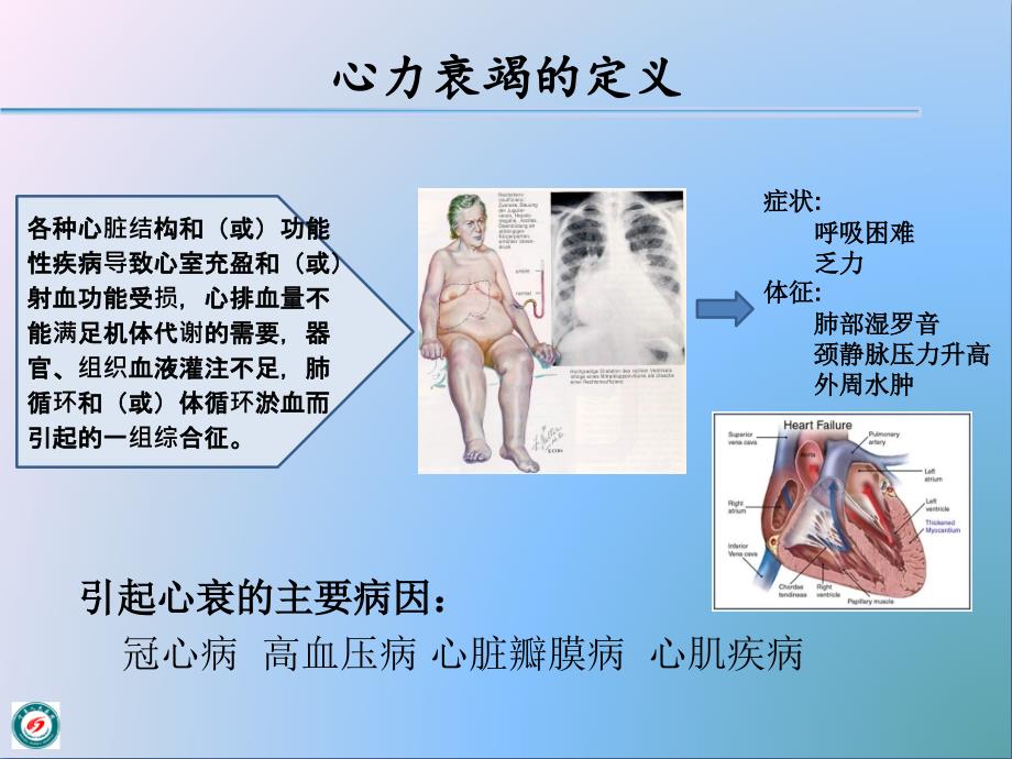 心力衰竭知识讲解_第2页