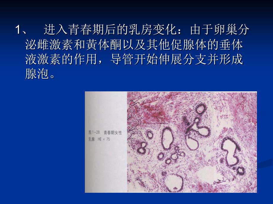 【5】乳腺增生病课件教学文稿_第4页