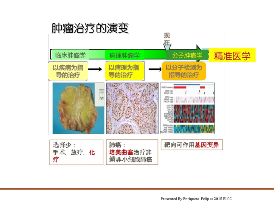 肺癌化疗进展教学文稿_第3页