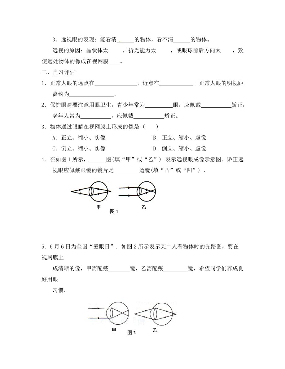 重庆市涪陵第十九中学八年级物理上册 5-4 眼睛和眼镜导学案（无答案）（新版）新人教版_第2页