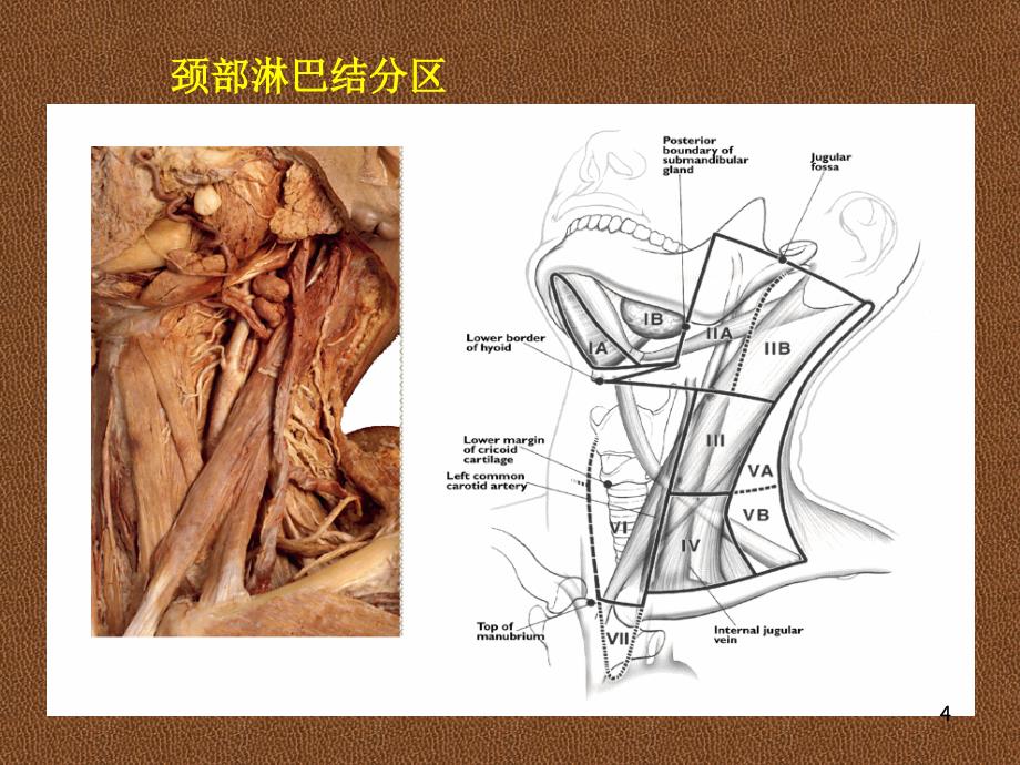 颈部淋巴结分区幻灯片_第4页