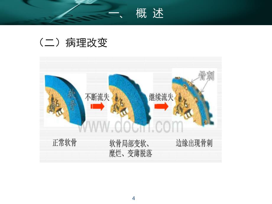 老年退行性骨关节病患者的护理PPT参考课件_第4页