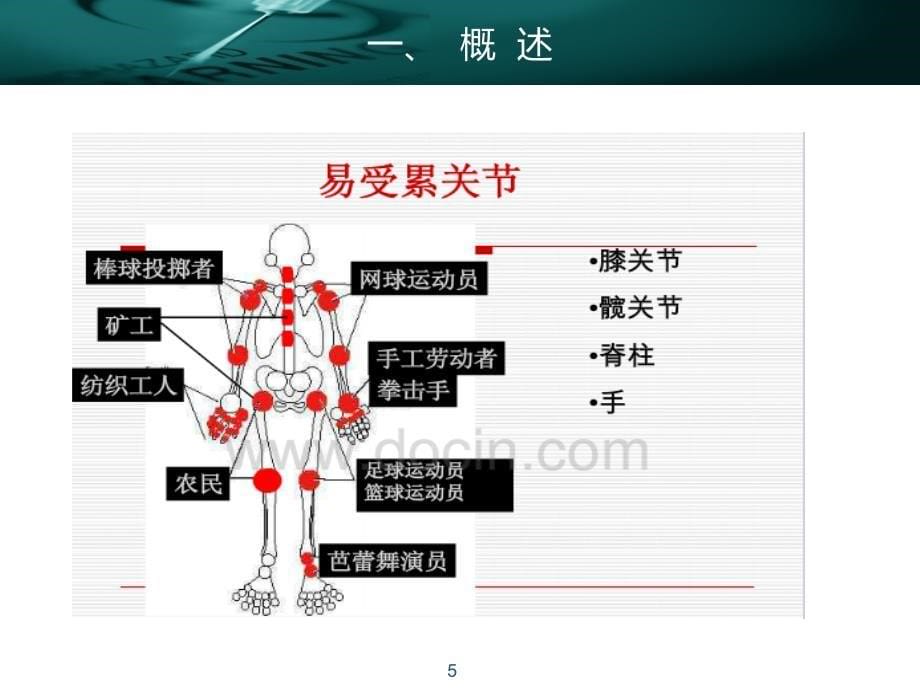 老年退行性骨关节病患者的护理PPT参考课件_第5页