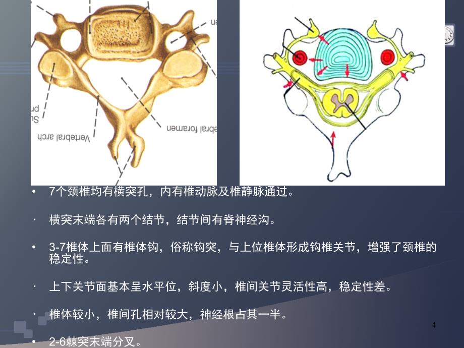 颈椎病的CT诊断PPT幻灯片_第4页