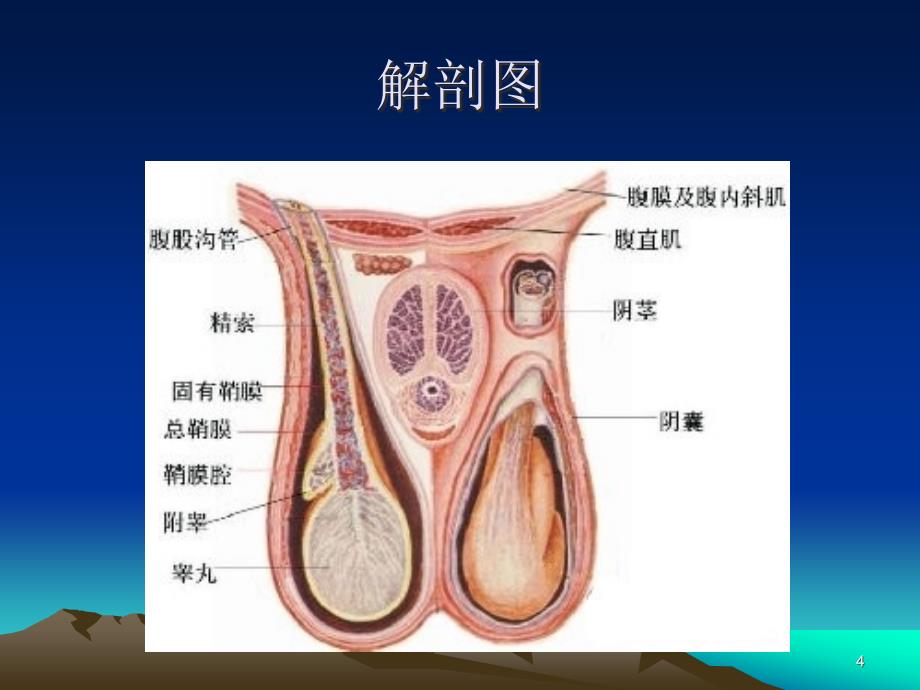 睾丸扭转的超声诊断PPT幻灯片_第4页