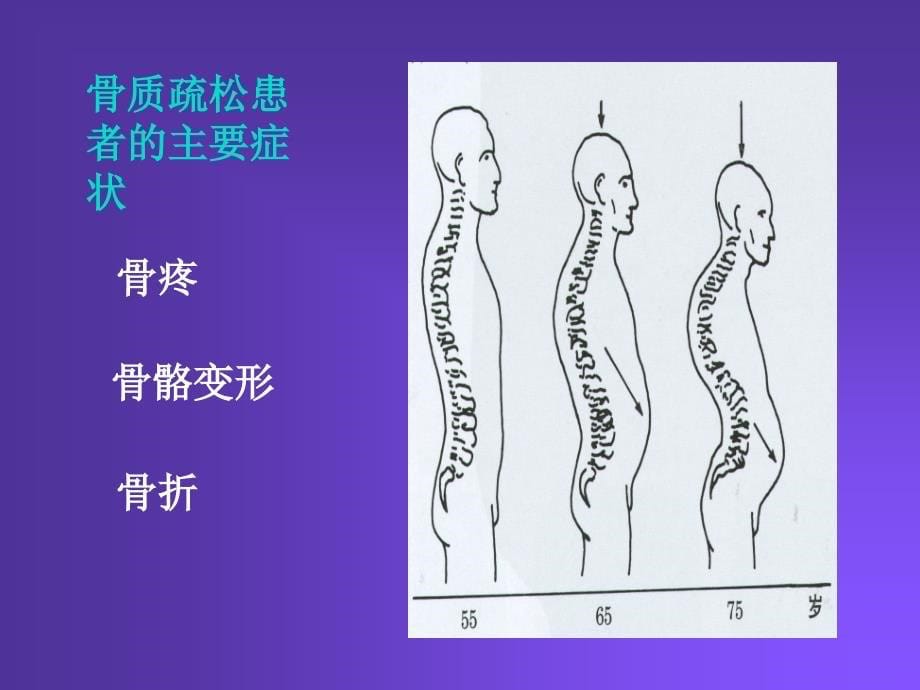 抗骨质疏松的药物说课讲解_第5页