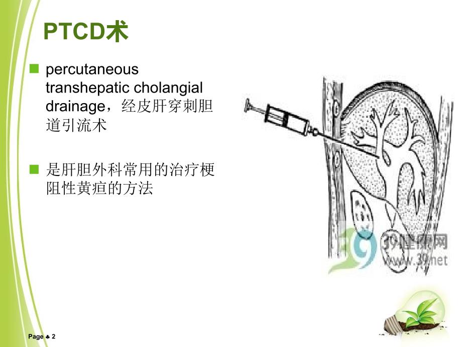 PTCD术及并发症的预防PPT参考课件_第2页