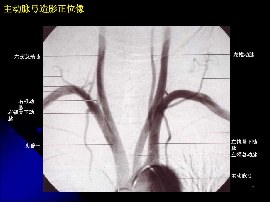 神经血管解剖图PPT参考课件_第2页