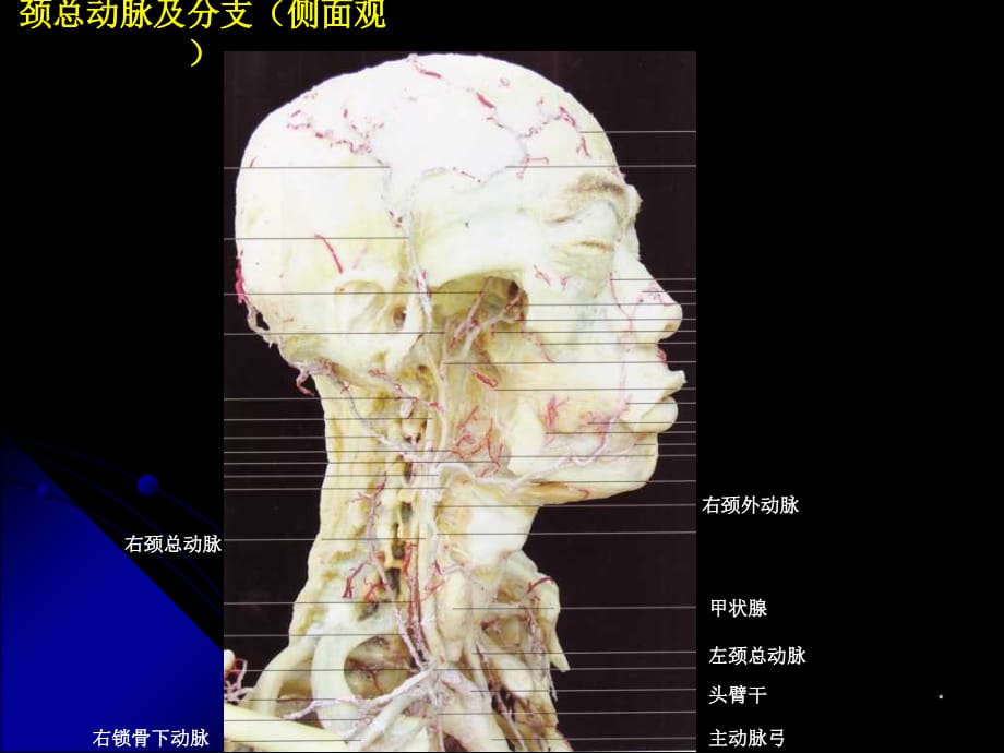 神经血管解剖图PPT参考课件_第4页