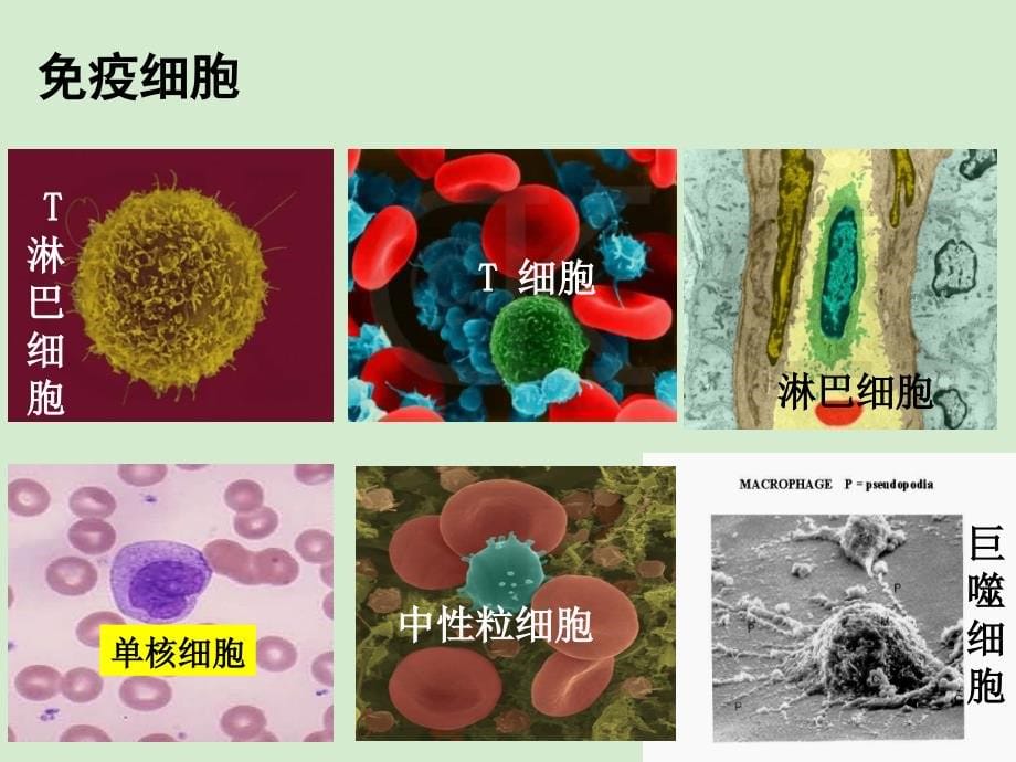 山东地区高中生物备课资料 免疫调节 必修3.ppt_第5页