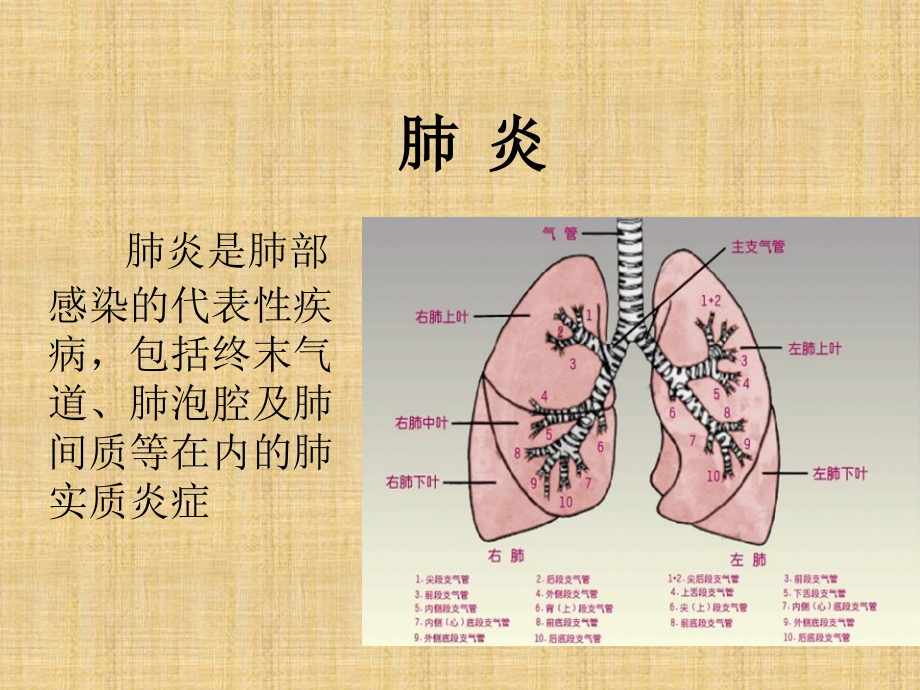 肺部感染精编PPT课件_第2页