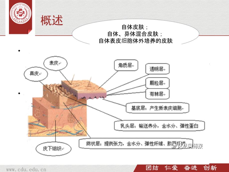 植皮病人的围手术期护理PPT参考幻灯片_第3页