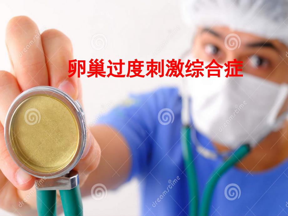 卵巢过度刺激综合征PPT精编PPT课件_第1页