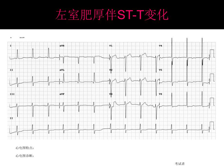 心电图考试(完整)_第1页