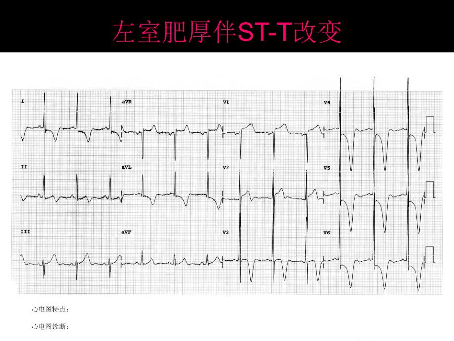 心电图考试(完整)_第3页