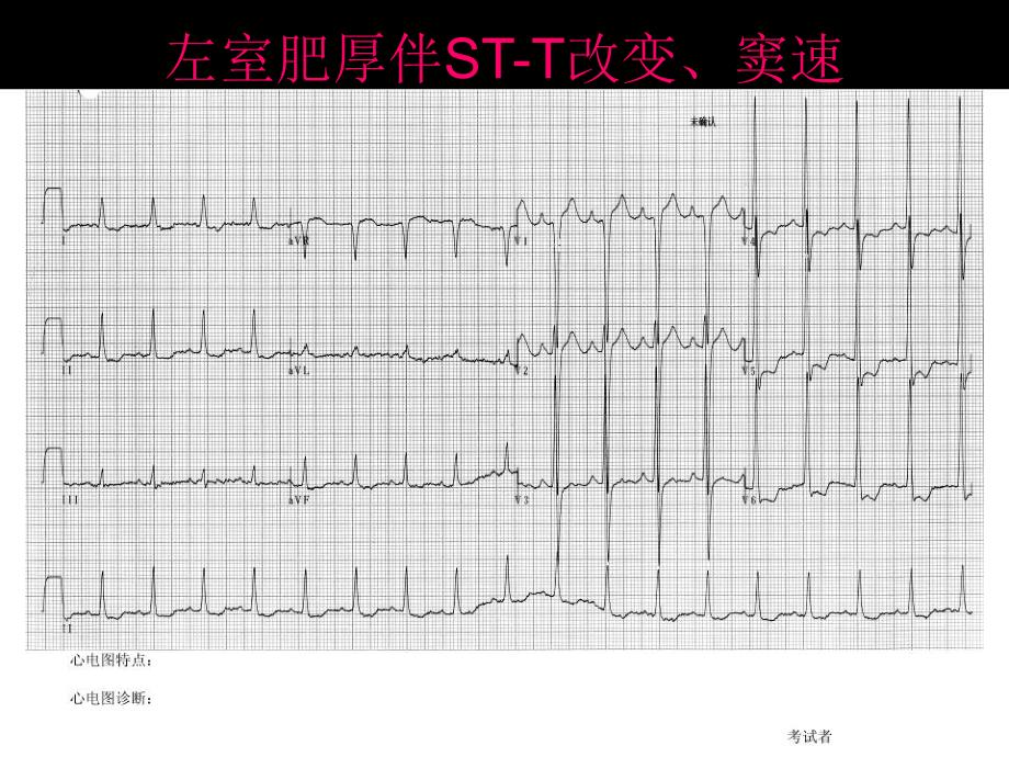 心电图考试(完整)_第4页
