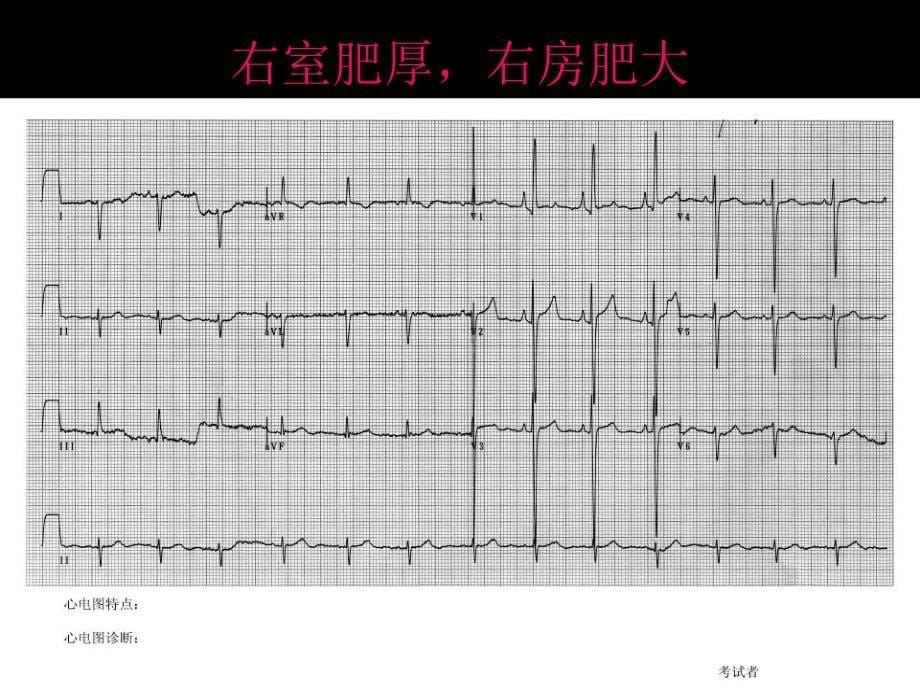 心电图考试(完整)_第5页