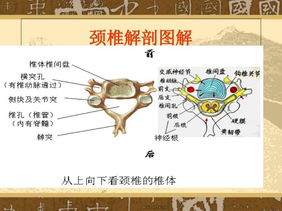 针刀治疗颈椎病教学文案_第5页