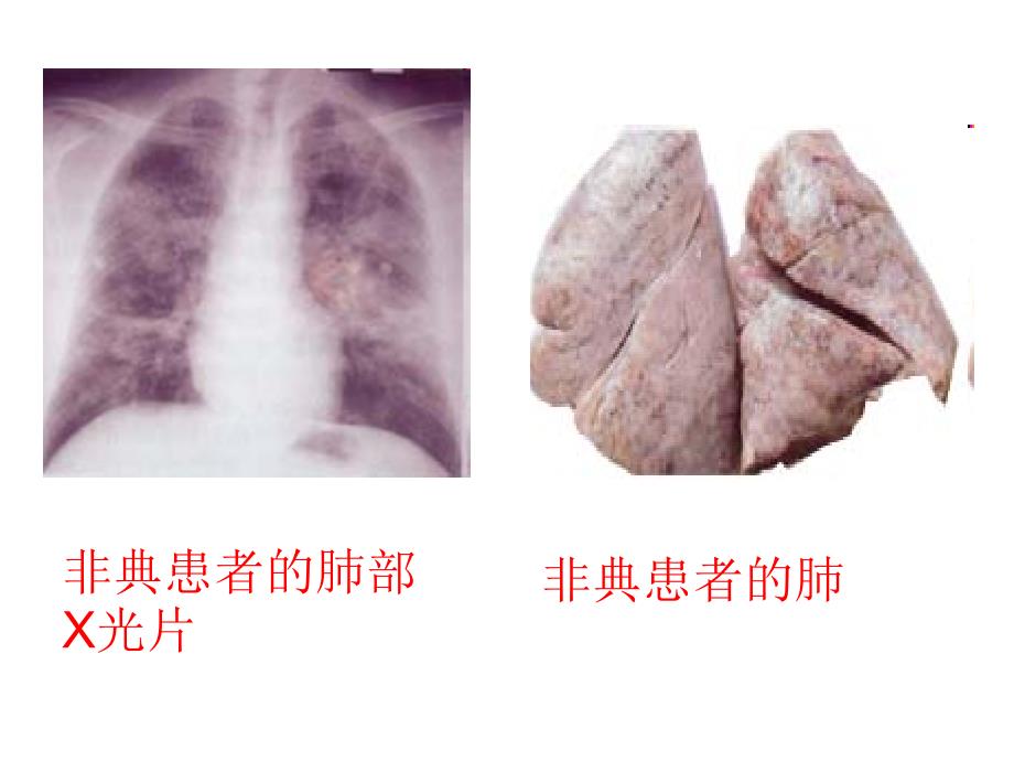 生物：3（四月）.3《生物技术药物与疫苗》课件（新人教版选修2）_第3页