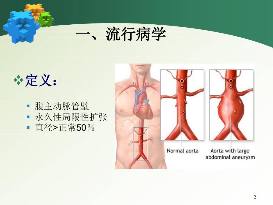 腹主动脉瘤PPT参考幻灯片_第3页