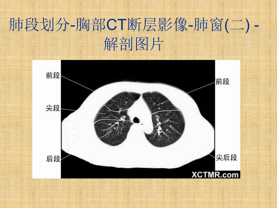 胸、上腹和盆腔CT详细实用图解精编PPT课件_第4页