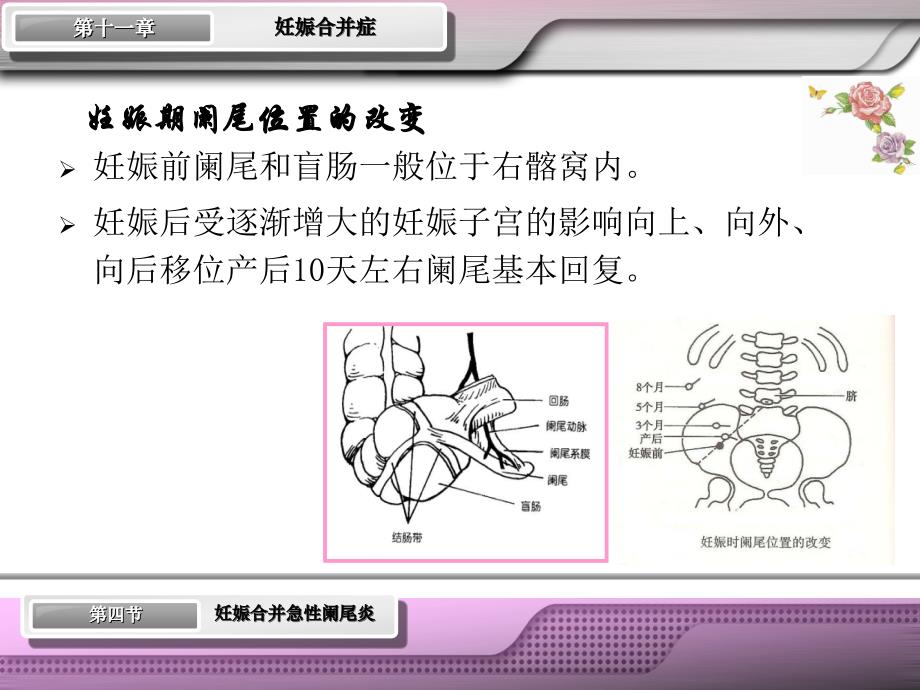 第十章妊娠合并阑尾炎精编PPT课件_第4页