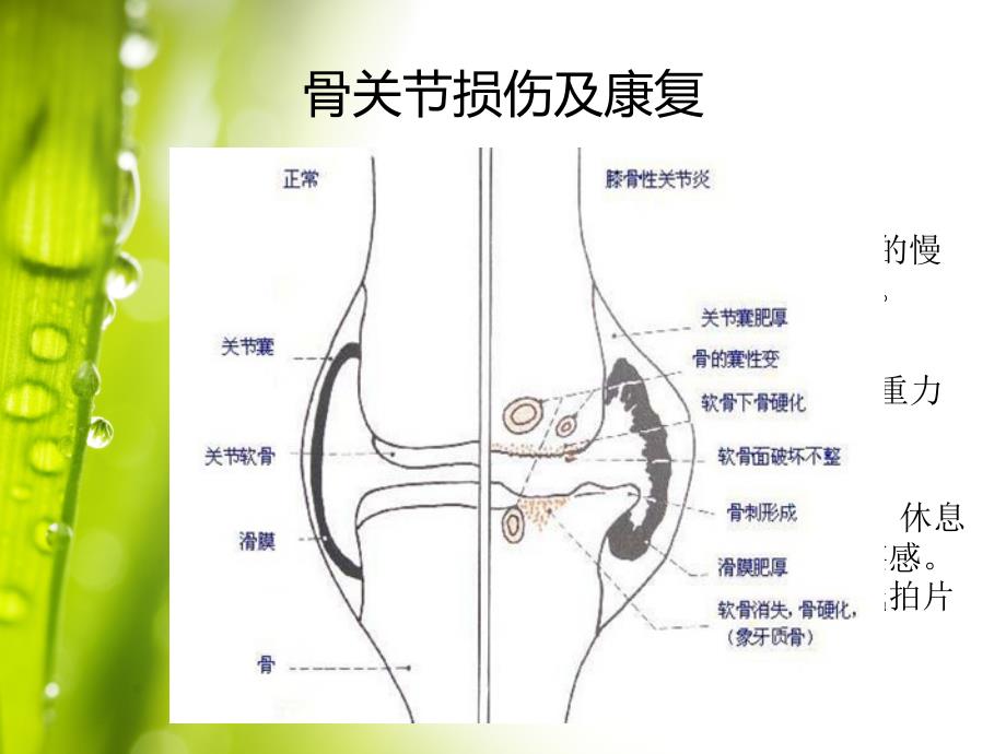 骨组织损伤PPT参考幻灯片_第4页