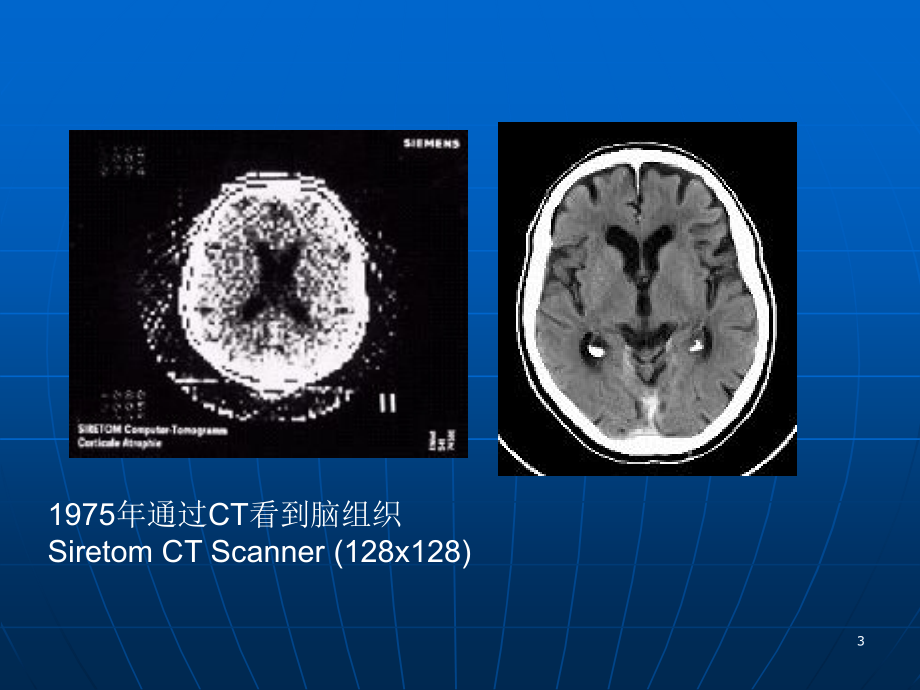头颅CT基本知识与常见疾病PPT参考幻灯片_第3页