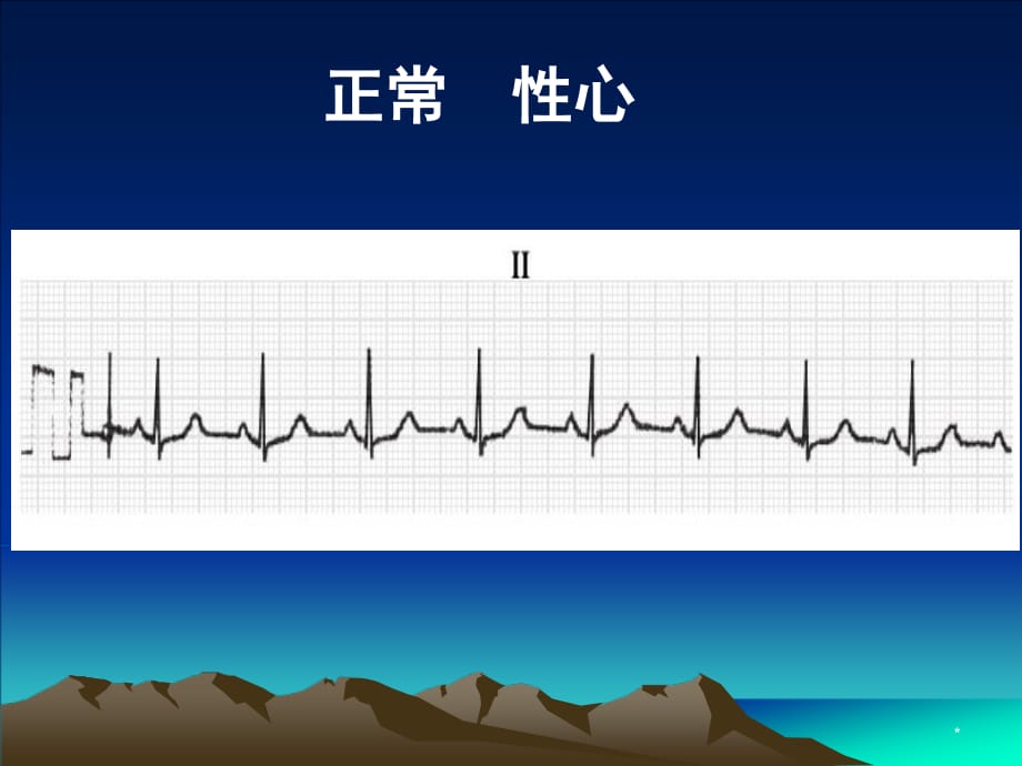 心电图基本知识PPT参考幻灯片_第2页