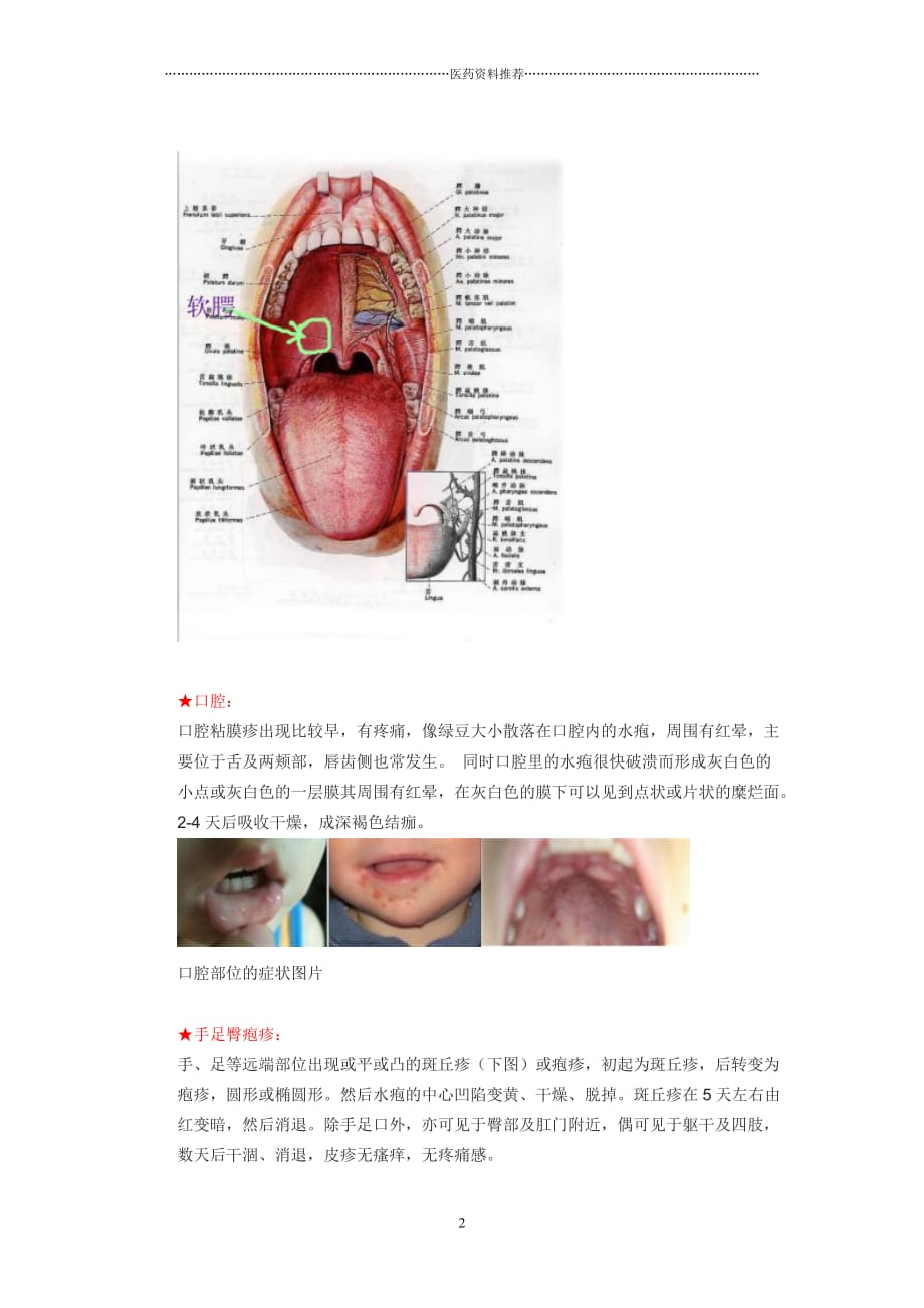 小儿手足口病症状及症状图片精编版_第2页