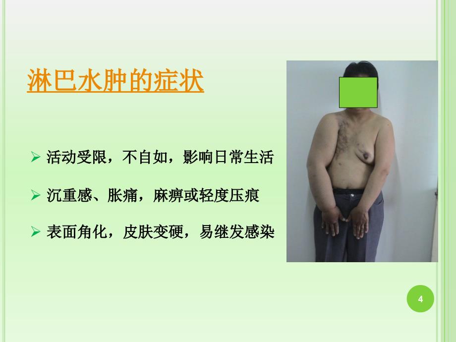 乳腺癌术后淋巴水肿的防治PPT参考幻灯片_第4页