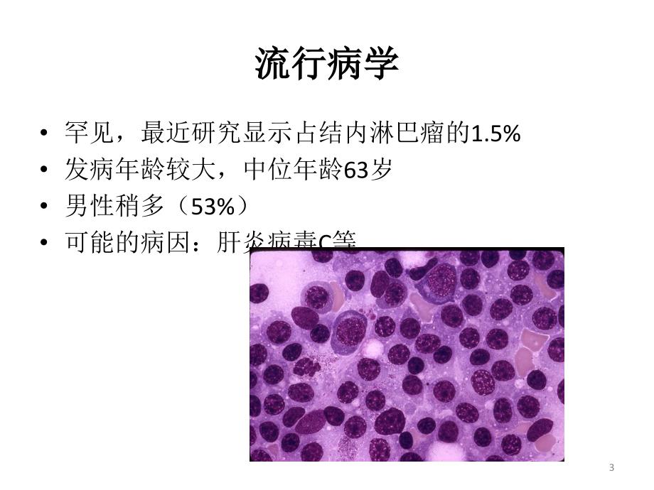 淋巴浆细胞淋巴瘤PPT参考幻灯片_第3页