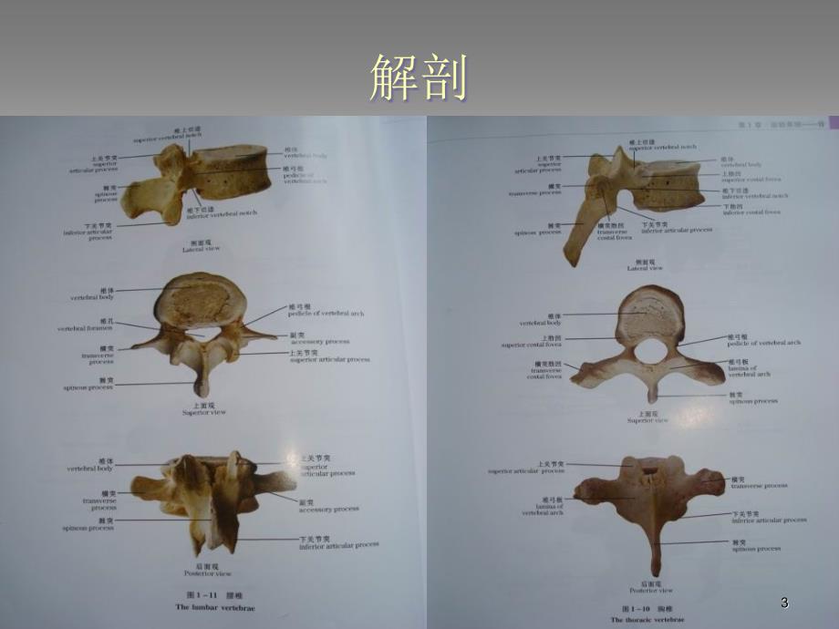 胸腰椎骨折的护理PPT参考幻灯片_第3页