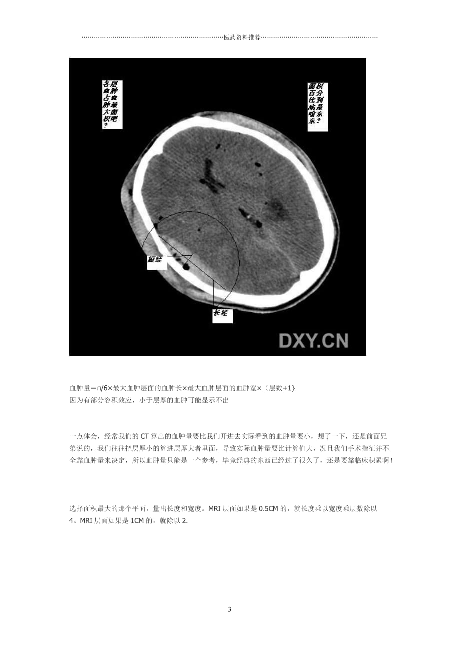 脑出血量的计算公式精编版_第3页